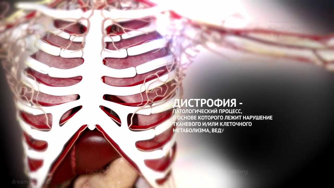 Dystrophies