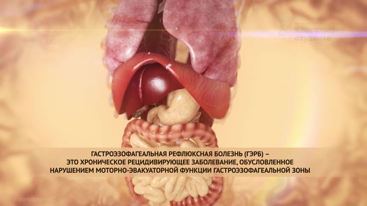 Гастроэзофагеальная рефлюксная болезнь - этиология и патогенез