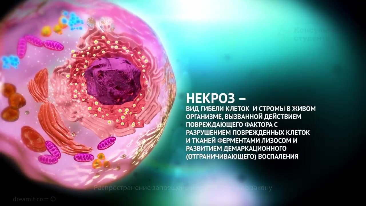 Necrosis and apoptosis