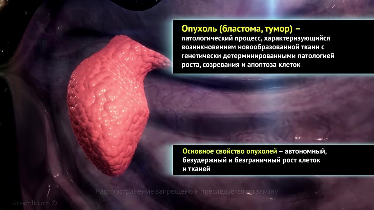 Tumours